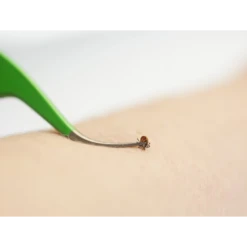 TickCheck Premium Tick Remover Set -Mutts And Co-us 3TickCheckPremiumTickRemoverSet